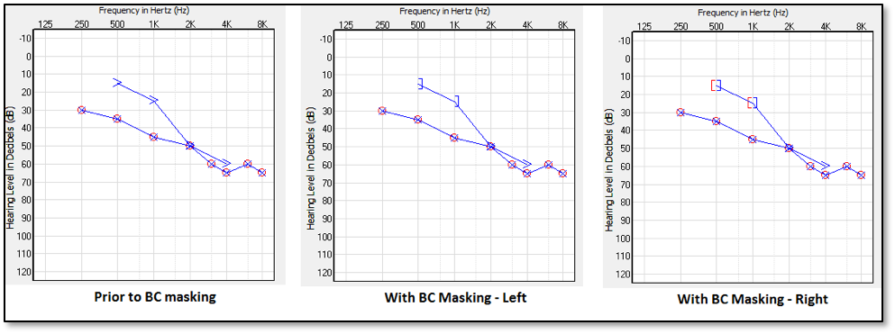 Air_Bone_Gaps_fitting1