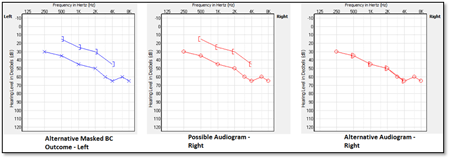 Air_Bone_Gaps_fitting2