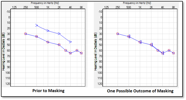 Air_Bone_Gaps_fitting3