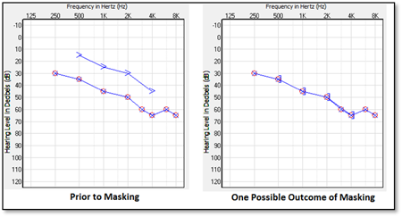 Air_Bone_Gaps_fitting3