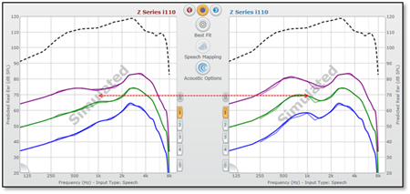 Air_Bone_Gaps_fitting4